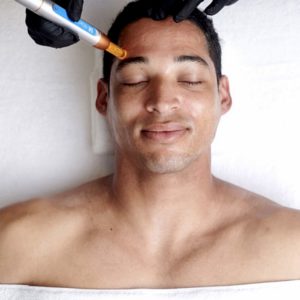 microneedling, schoonheidssalon in Enschede, kapsalon in Enschede